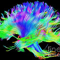 Fiber Tracts Of The Brain, Dti Photograph by Living Art Enterprises Fiber Tracts Of The Brain, Dti Photograph by Living Art Enterprises