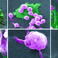 Cancer Cell Death Sequence, Sem #5  by Science Source