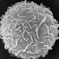 Mast Cell SEM Photograph by Don Fawcett and E Shelton and Photo Researchers Mast Cell SEM Photograph by Don Fawcett and E Shelton and Photo Researchers