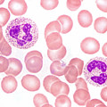 Neutrophils In Peripheral Blood Smear Photograph by M. I. Walker Neutrophils In Peripheral Blood Smear Photograph by M. I. Walker
