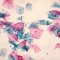 Pap Smear Photograph by Science Source Pap Smear Photograph by Science Source