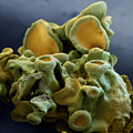 Common Orange Lichen Photograph by Meckes/ottawa Common Orange Lichen Photograph by Meckes/ottawa