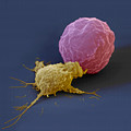 Killer Cell And Cancer Cell Photograph by Meckes/ottawa Killer Cell And Cancer Cell Photograph by Meckes/ottawa