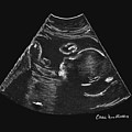 Ultrasound baby by Carol Morris